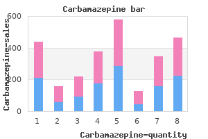 order carbamazepine pills in toronto