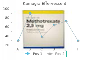 order kamagra effervescent american express