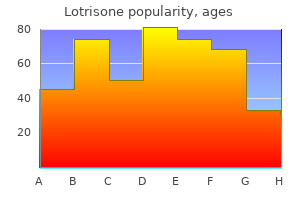 order lotrisone 10 mg online