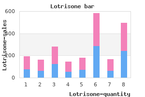 trusted 10 mg lotrisone